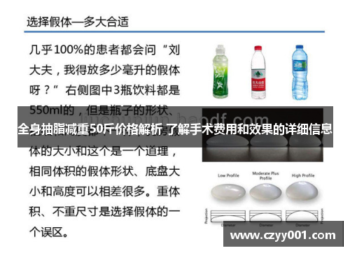 全身抽脂减重50斤价格解析 了解手术费用和效果的详细信息